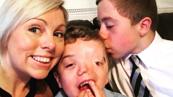 Fotos | Madre denunció a Instagram por censurar el rostro con deformidad de su hijo y sus seguidores le dieron todo su apoyo