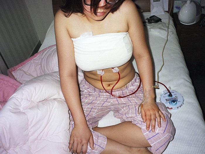 Impactante: Crudas fotografías muestran el dolor de mujeres coreanas tras cirugías plásticas