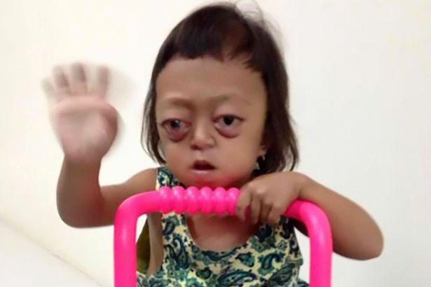 Fotos | Esta niña de 5 años fue esclavizada y golpeada por traficantes para que mendigara e hiciera más dinero para ellos