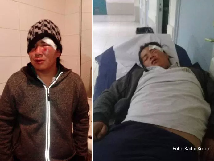 Denuncian a parceleros por brutal golpiza a joven mapuche en Ercilla