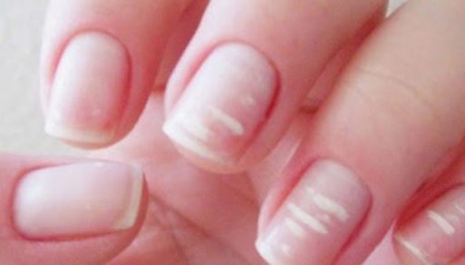 6 señales en tus uñas que indican problemas de salud