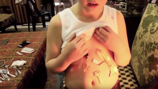 (VIDEO) El extraño caso del ‘niño magnético’ que atrae metales a su barriga como si fuera un imán