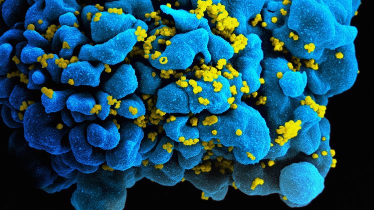 Droga contra el cáncer parece ser una vía para curar el VIH
