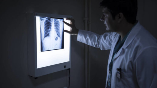 Científicos dan con dos causas del cáncer que hasta ahora eran desconocidas