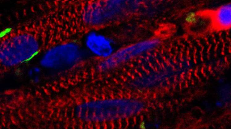 Científicos cultivan músculo funcional usando células madre de la piel por primera vez