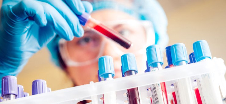 Un nuevo examen de sangre que usa el ADN podría detectar ocho de los cánceres más comunes