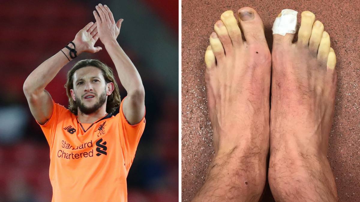Jugador del Liverpool muestra sus pies congelados tras jugar ante el Southampton