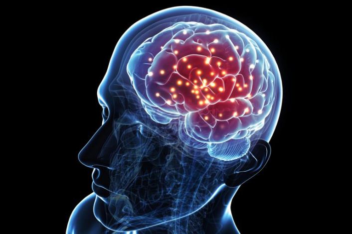 Científicos trabajan en una droga que ayude a reconectar el cerebro después de un derrame cerebral