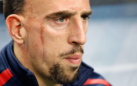 «Lloraba a escondidas»: la dramática infancia de Ribery y la historia de su cicatriz de cien puntos