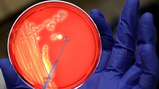 EE.UU. da a conocer la primera muerte por brote de E. coli en lechugas