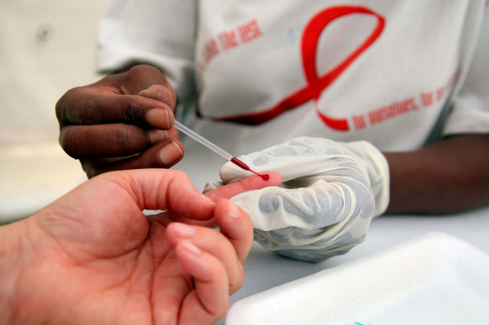 Estudio señala que uso de antirretrovirales y circuncisión podría reducir contagio de VIH-Sida