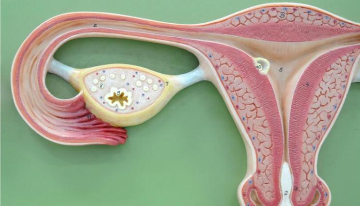 Científicos descubren la causa del síndrome de ovario poliquístico y proponen una cura