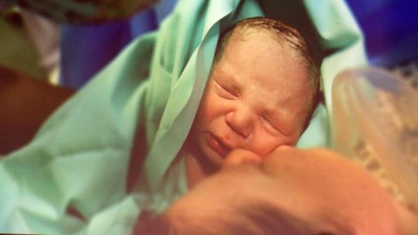 En Italia nace el primer bebé fruto de un trasplante de útero entre gemelas