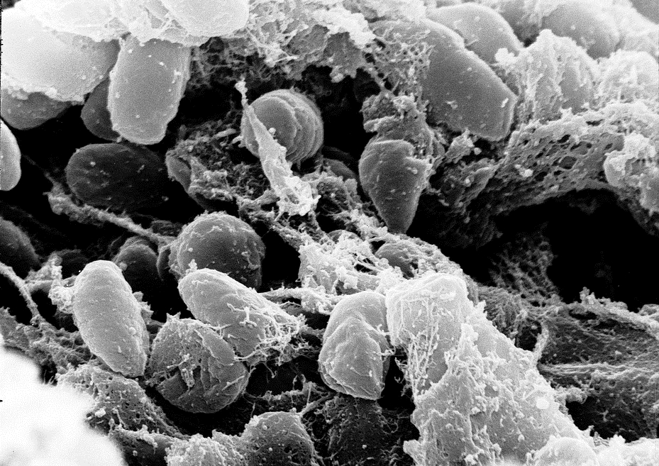 Un nuevo caso de peste bubónica aparece en Estados Unidos