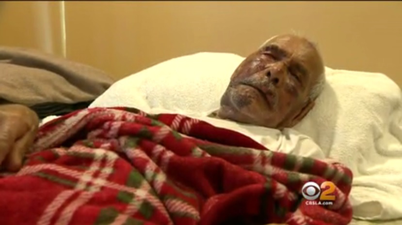 Una mujer le dio un paliza a un abuelo de 92 años y le gritó comentarios racistas