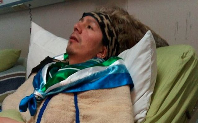 Médico del machi Celestino Córdova: “Él siente que fue torturado”