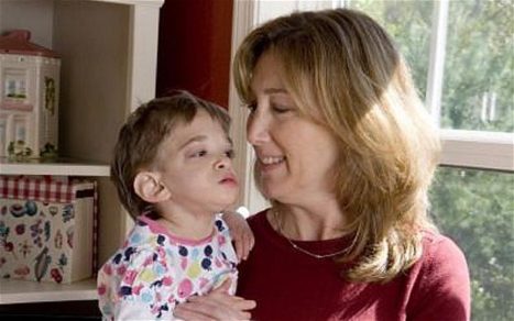 Brooke Greenberg: La joven que podría tener el secreto de la juventud eterna