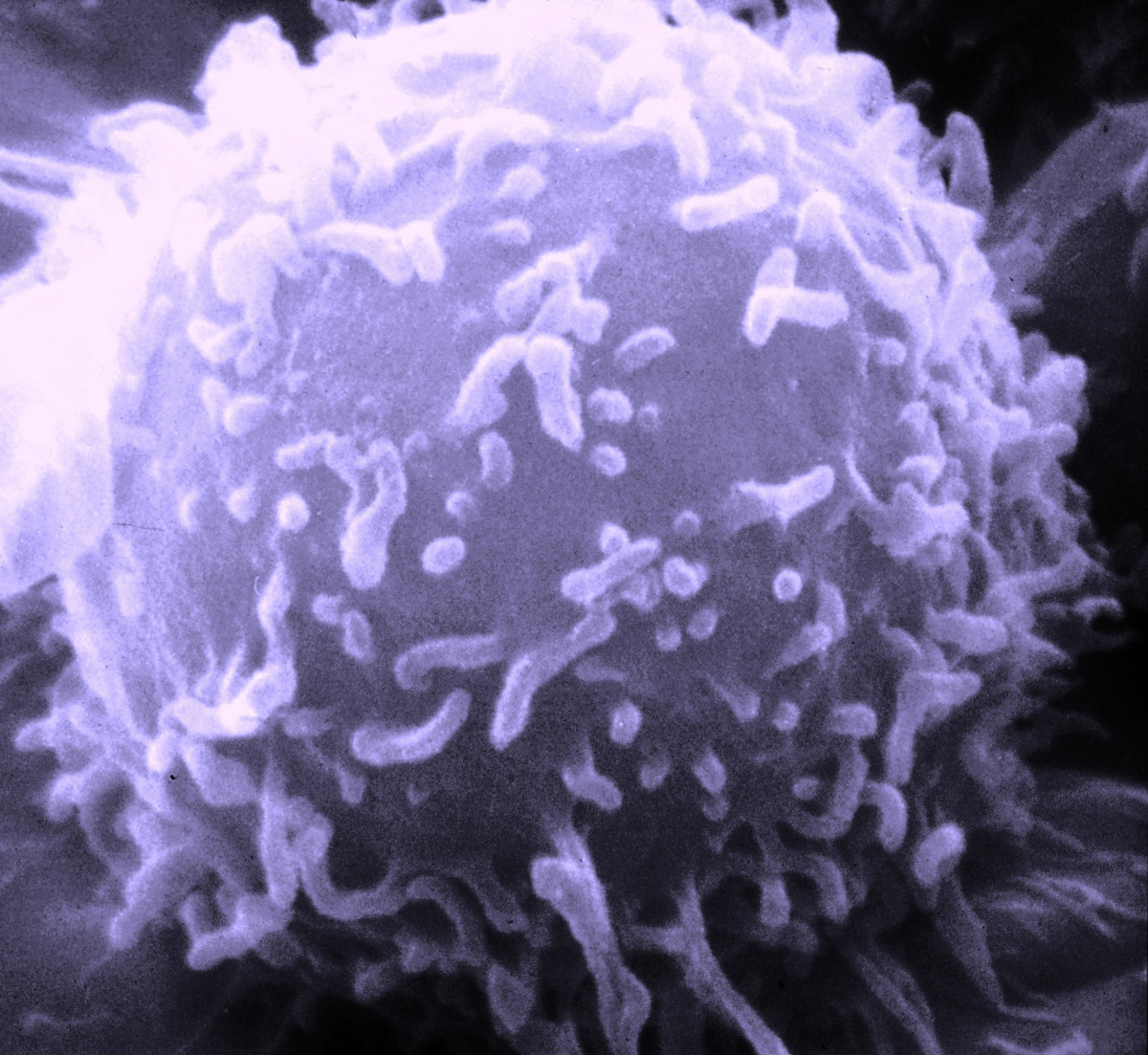 Importante resultado: Se mejorará la eficiencia de las células que matan el cáncer