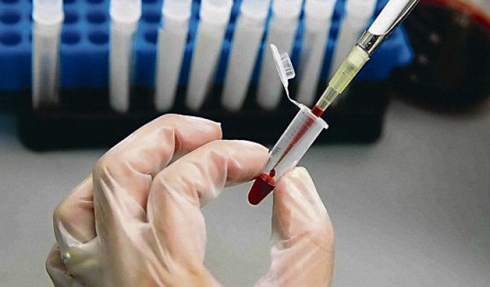 Éxito rotundo: Primeras pruebas en humanos de la vacuna contra el Sida