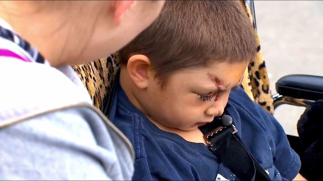 (+Fotos) ¡Repudiable! Niño de seis años con autismo recibió brutal golpiza por defender a un amigo