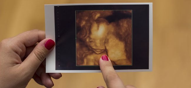 Padres no videntes perciben el rostro de su bebé en 3D