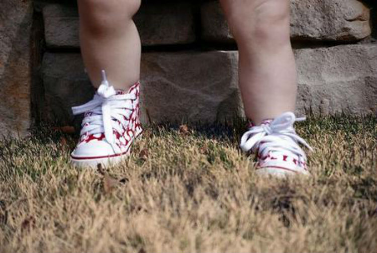 (Fotos) Una niña de 4 años contrae una peligrosa bacteria tras probarse unos zapatos