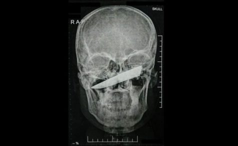 cuchillo