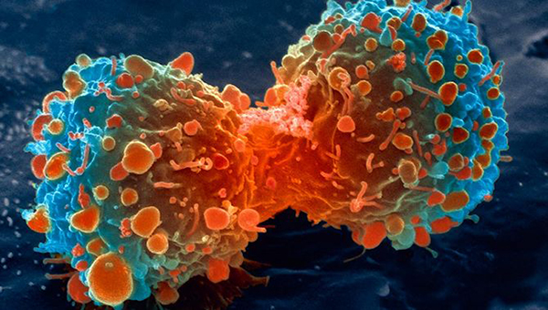 Vacuna contra el cáncer demuestra ser 100% efectiva en melanomas agresivos