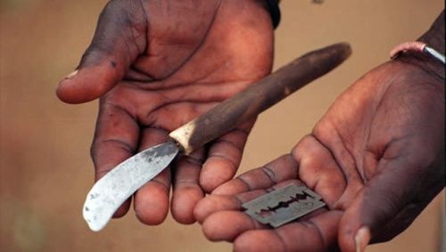 Hospitalizadas 50 niñas de Burkina Faso por mutilación genital