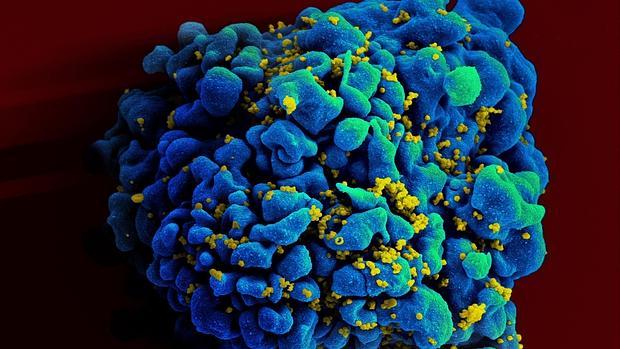 Inmunoterapia suprime temporalmente el virus del VIH
