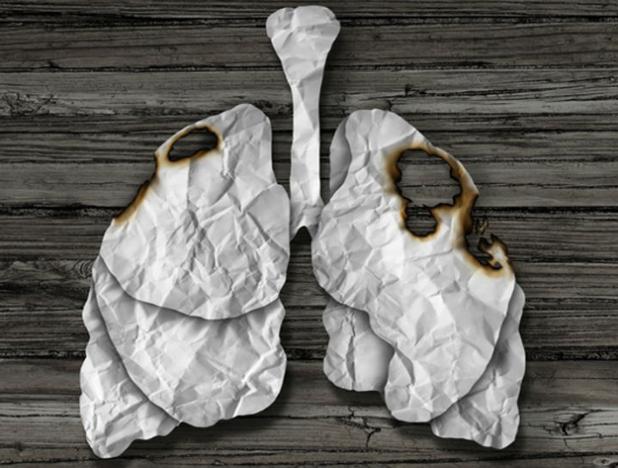 ¿Qué genera el cáncer del pulmón aparte del cigarrillo?