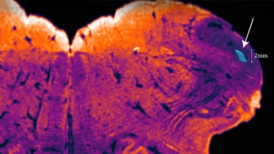 Un neurocientífico descubre una nueva región del cerebro