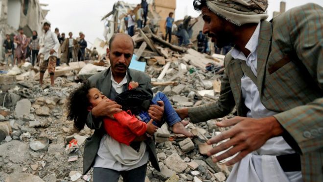 Guerra olvidada: Conflicto en Yemen y el papel de las potencias