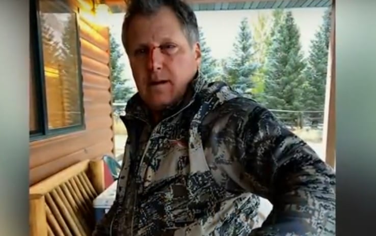 (Video) Un cazador explica cómo sobrevivió al ataque de un oso grizzly