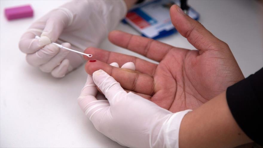 Descubren fórmula para eliminar células infectadas por el VIH