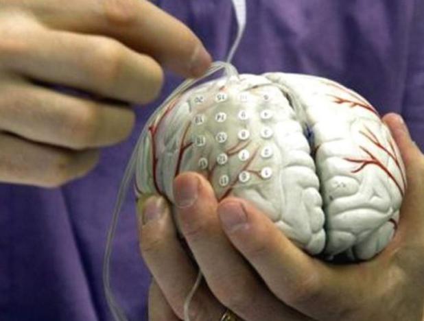 Científicos estadounidenses crearon un marcapasos cerebral