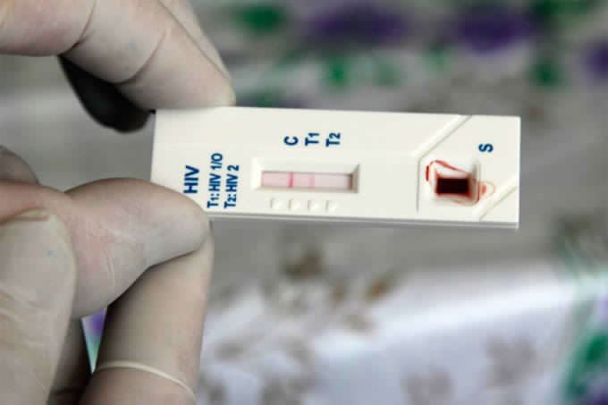 Gratuito: Movilh aplicará test rápido de VIH en su sede a partir de este lunes
