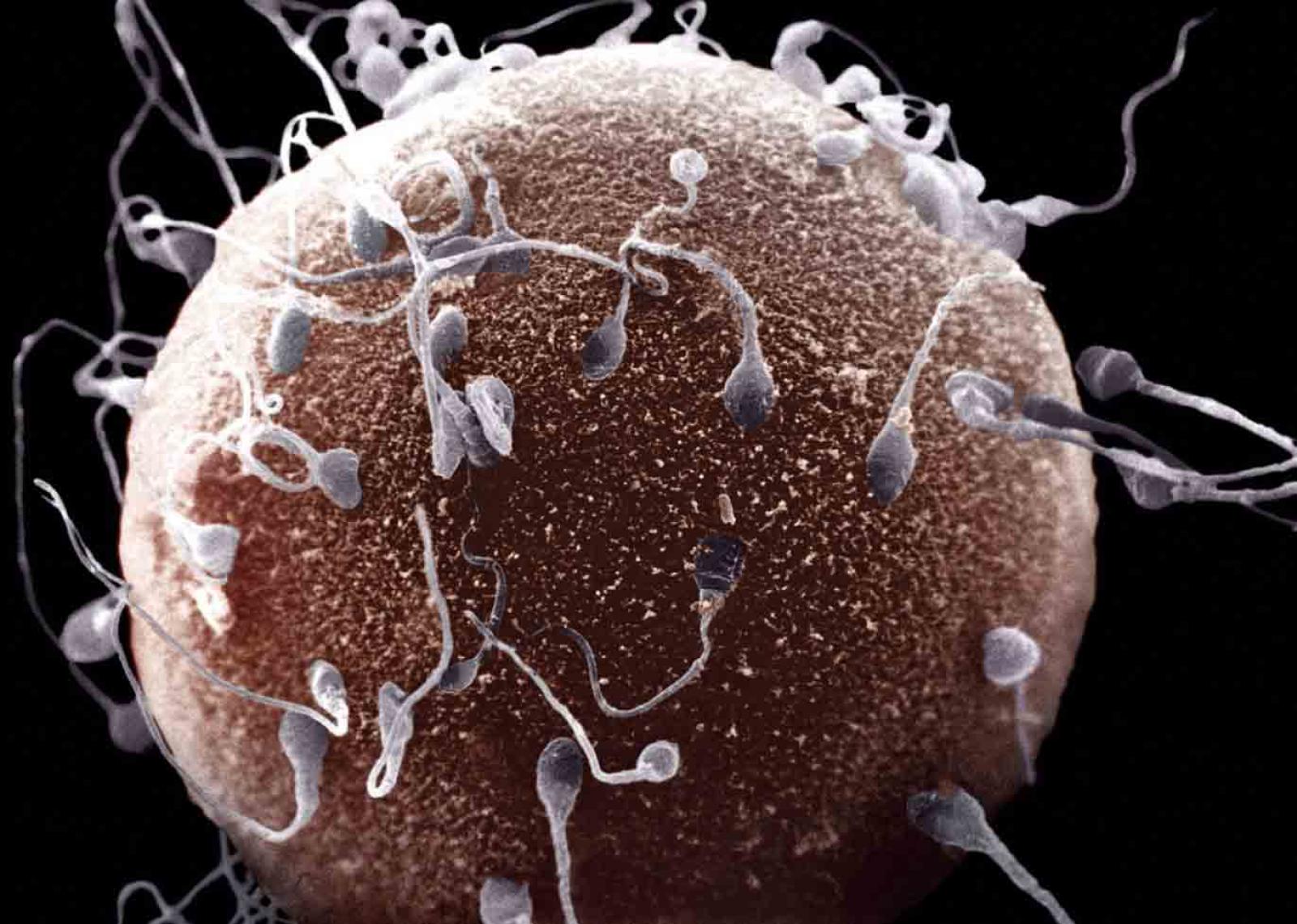 El esperma dañado podría cumplir un rol en los abortos espontáneos sucesivos