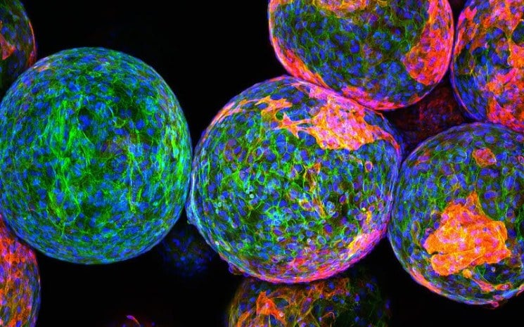 Científicos convierten células madre humanas en células productoras de insulina por primera vez