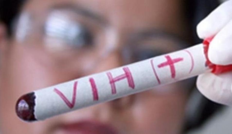 Congreso: Especialistas expusieron sobre medidas de prevención del VIH