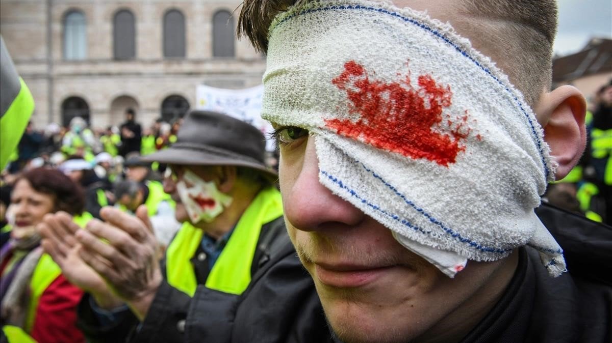 Francia: Los ‘chalecos amarillos’ heridos crean una asociación para combatir la brutalidad policial
