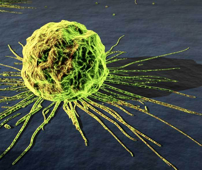 Investigadores hacen nuevos descubrimientos que podrían eliminar las células madre del cáncer