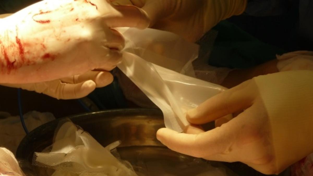 Crean nueva piel artificial con células madre para uso en quemados