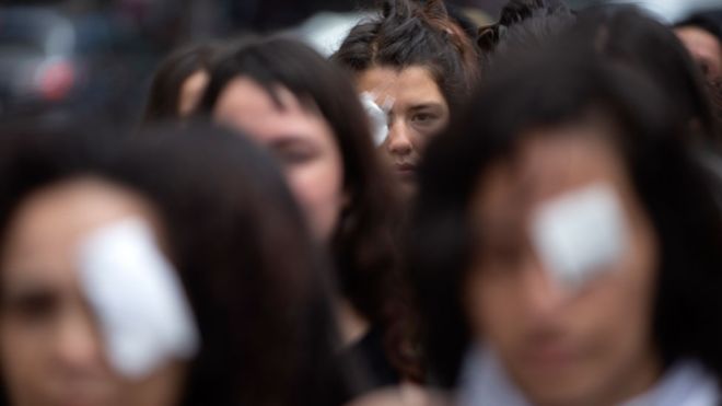 Universidad de Chile: «Prótesis oculares gratis ante violencia de agentes del Estado»