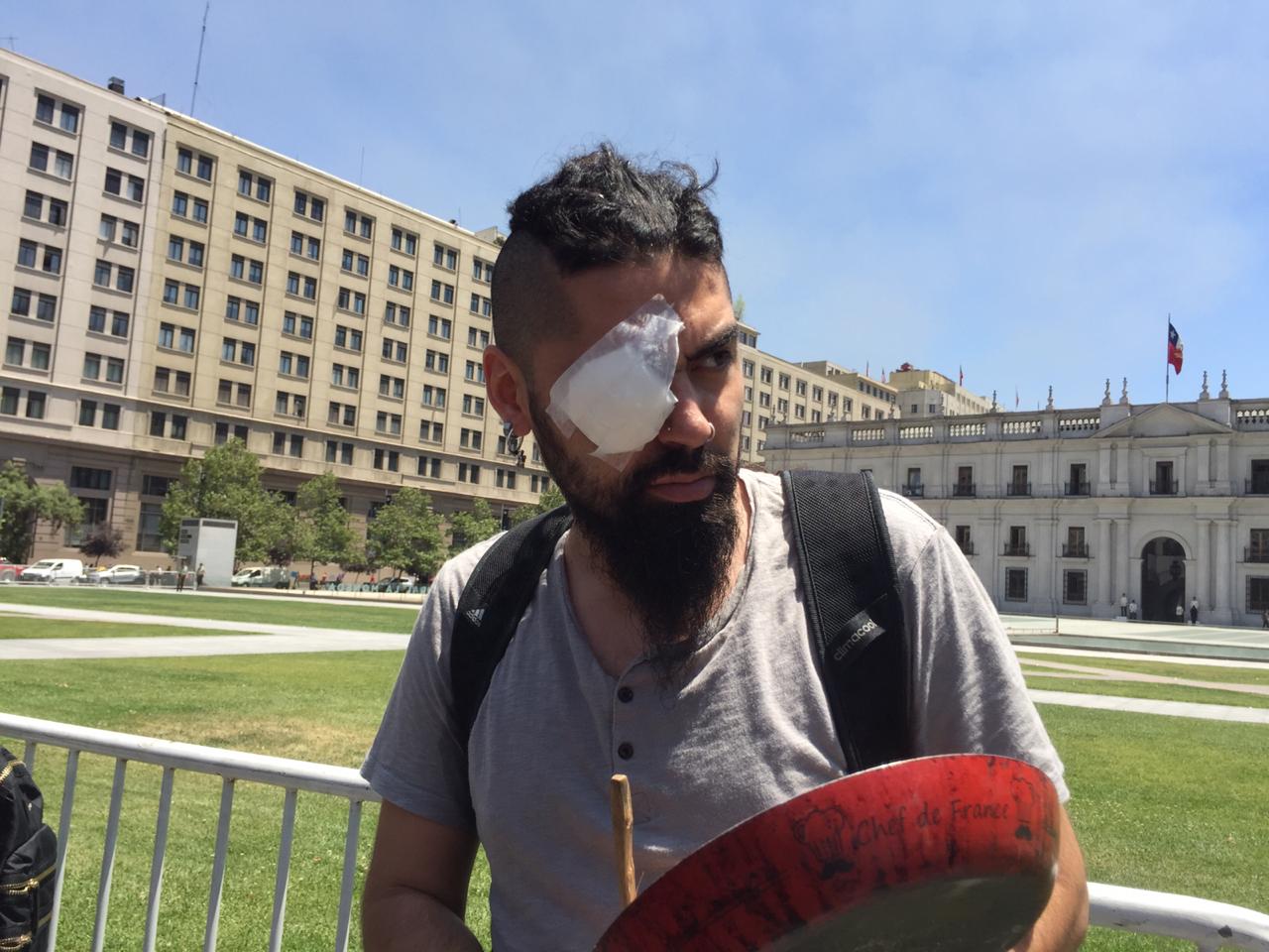 Víctimas de disparos de Carabineros en los ojos exigieron justicia en La Moneda: Anunciaron querella contra Piñera