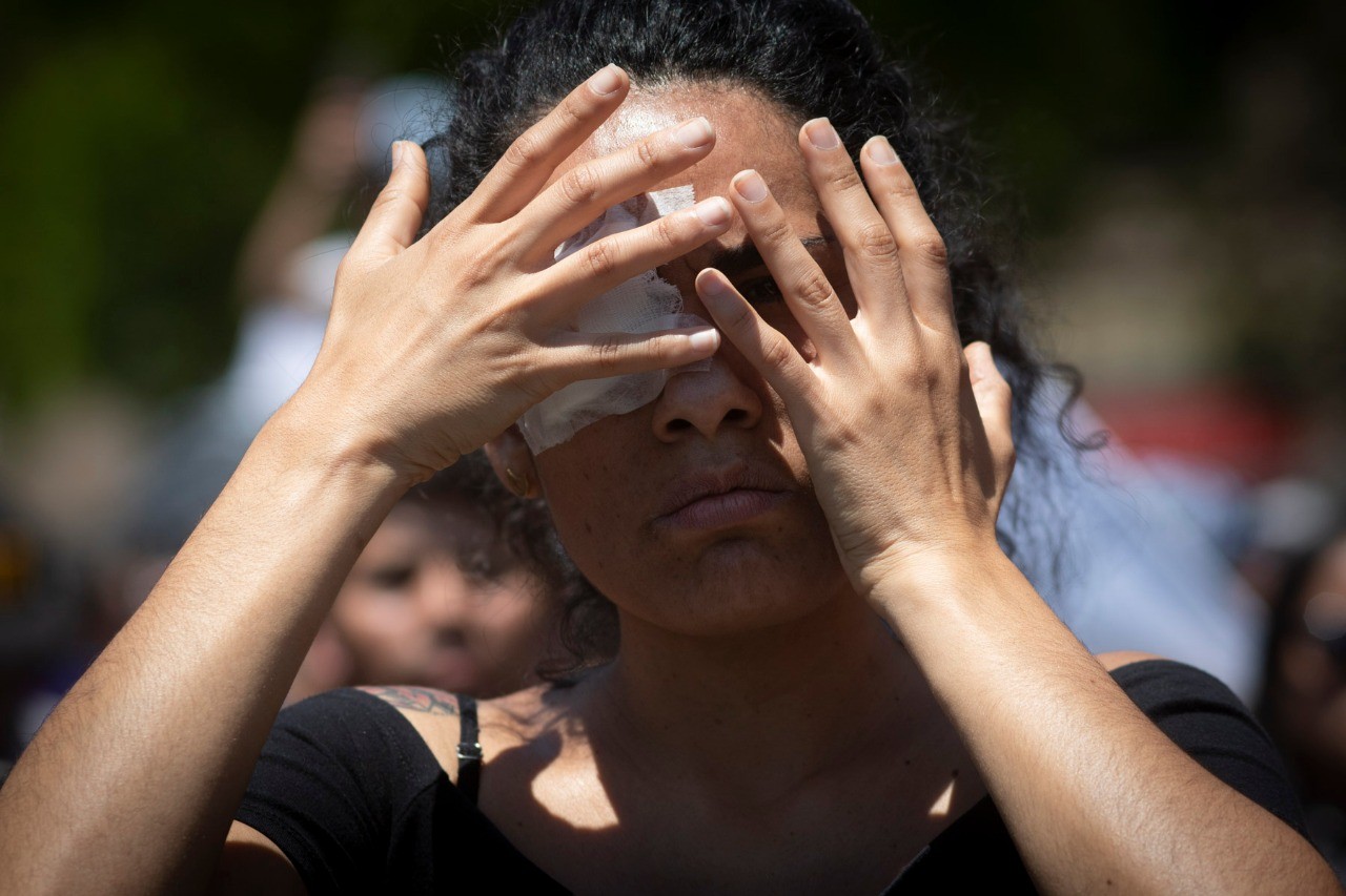 Todos con parche en el ojo: El llamado a manifestarse por las víctimas de lesiones oculares
