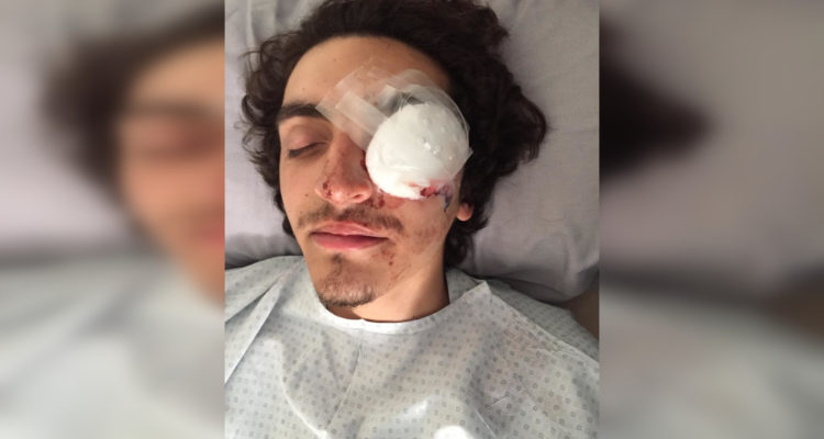 Universidad de Chile denunciará a Carabineros que agredieron a estudiante que perdió un ojo