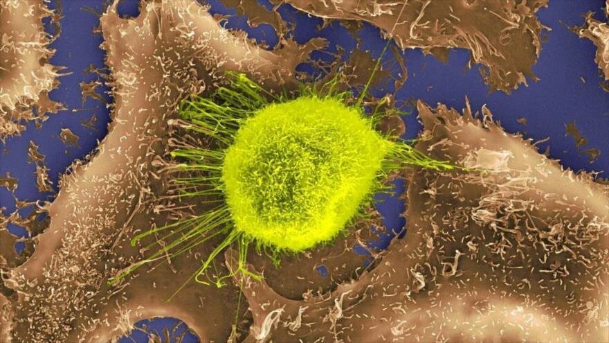 Diseñan virus basado en la viruela de la vaca para destruir todo tipo de cáncer