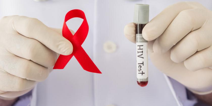 Día Mundial del Sida: Estos son los principales mitos sobre el VIH