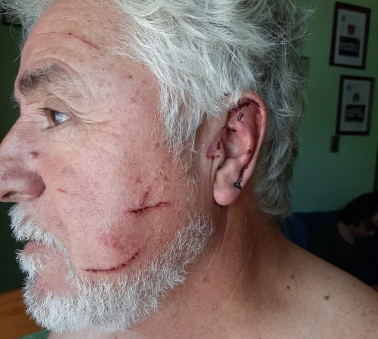 Dirigente de la pesca artesanal denuncia brutal agresión y persecución por parte de Carabineros